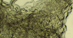 Nematode (Caenorhabditis elegans)